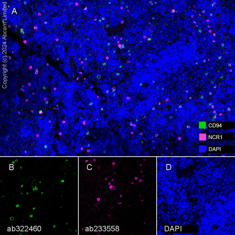 Multiplex immunohistochemistry - Anti-NCR1/NKp46 antibody [EPR23097-35] (AB233558)