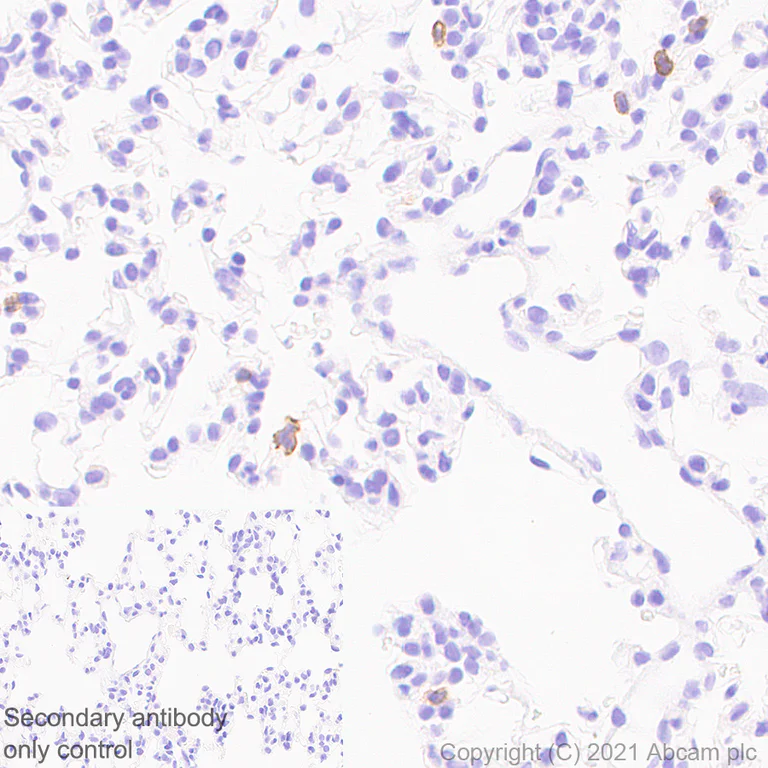 Immunohistochemistry (Formalin/PFA-fixed paraffin-embedded sections) - Anti-NCR1/NKp46 antibody [mNCR1.05] (AB283505)