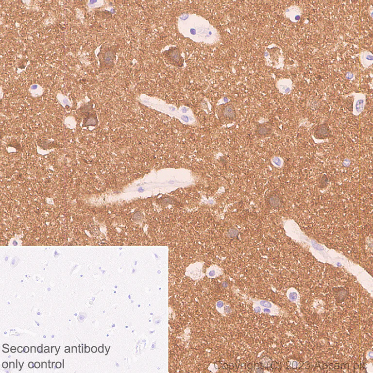 Immunohistochemistry (Formalin/PFA-fixed paraffin-embedded sections) - Anti-NCS1 antibody [EPR7699] (AB129166)