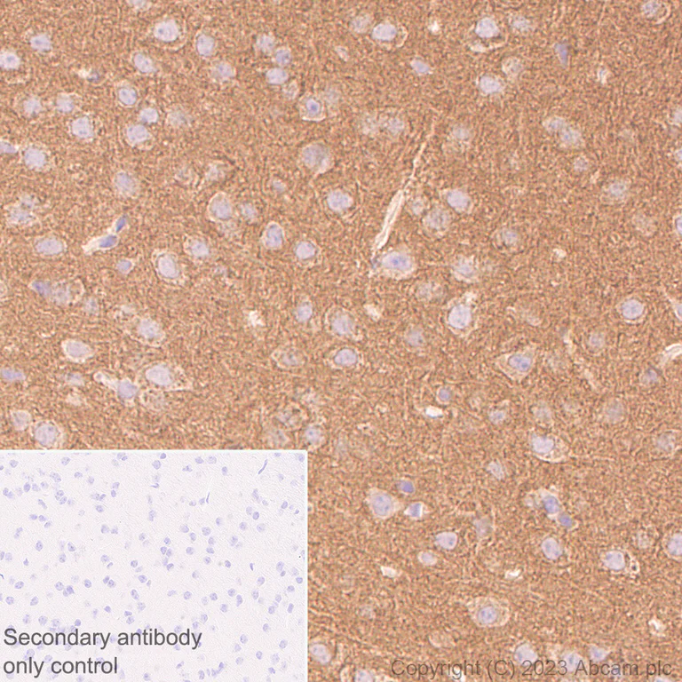 Immunohistochemistry (Formalin/PFA-fixed paraffin-embedded sections) - Anti-NCS1 antibody [EPR7699] (AB129166)