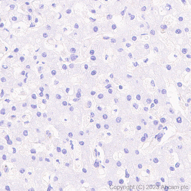 Immunohistochemistry (Formalin/PFA-fixed paraffin-embedded sections) - Anti-NCS1 antibody [EPR7699] (AB129166)