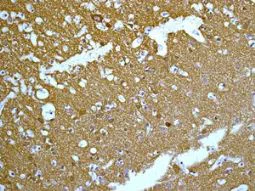 Immunohistochemistry (Formalin/PFA-fixed paraffin-embedded sections) - Anti-NCS1 antibody [EPR7699] (AB129166)