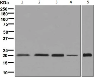 Western blot - Anti-NCS1 antibody [EPR7699] (AB129166)