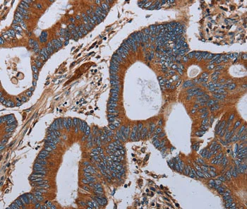 Immunohistochemistry (Formalin/PFA-fixed paraffin-embedded sections) - Anti-ND6 antibody (AB198784)