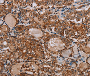 Immunohistochemistry (Formalin/PFA-fixed paraffin-embedded sections) - Anti-ND6 antibody (AB198784)