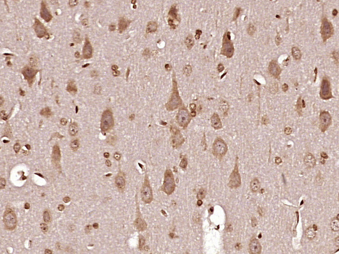 Immunohistochemistry (Formalin/PFA-fixed paraffin-embedded sections) - Anti-ND6 antibody (AB214224)