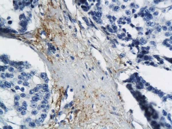 Immunohistochemistry (Formalin/PFA-fixed paraffin-embedded sections) - Anti-ND6 antibody (AB214224)