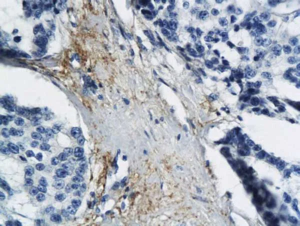 Immunohistochemistry (Formalin/PFA-fixed paraffin-embedded sections) - Anti-ND6 antibody (AB214224)