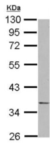 Western blot - Anti-NDE1 antibody (AB127032), expandable thumbnail