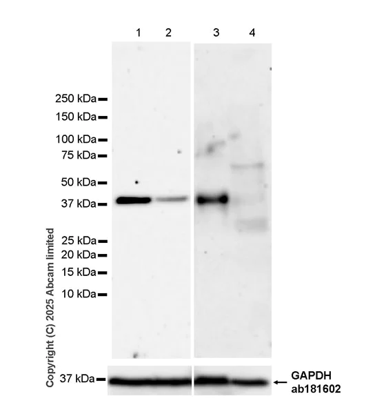 Western blot - Anti-NDE1 antibody [EPR30443-553] (AB324144)