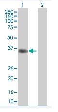 Western blot - Anti-NDFIP2 antibody (AB67912), expandable thumbnail