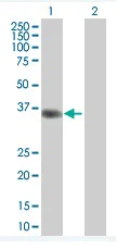 Western blot - Anti-NDFIP2 antibody (AB67912)