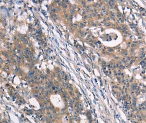 Immunohistochemistry (Formalin/PFA-fixed paraffin-embedded sections) - Anti-NDNL2 antibody (AB198686), expandable thumbnail