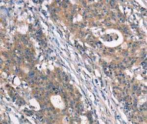 Immunohistochemistry (Formalin/PFA-fixed paraffin-embedded sections) - Anti-NDNL2 antibody (AB198686)