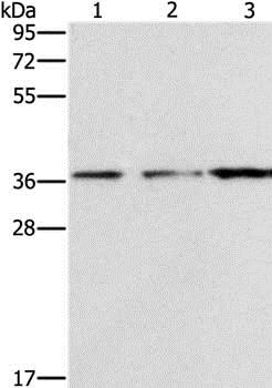 Western blot - Anti-NDNL2 antibody (AB198686), expandable thumbnail