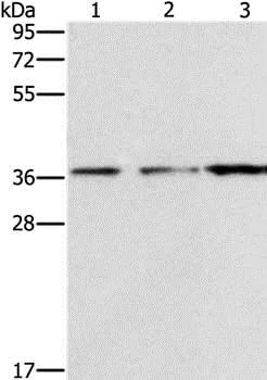 Western blot - Anti-NDNL2 antibody (AB198686)