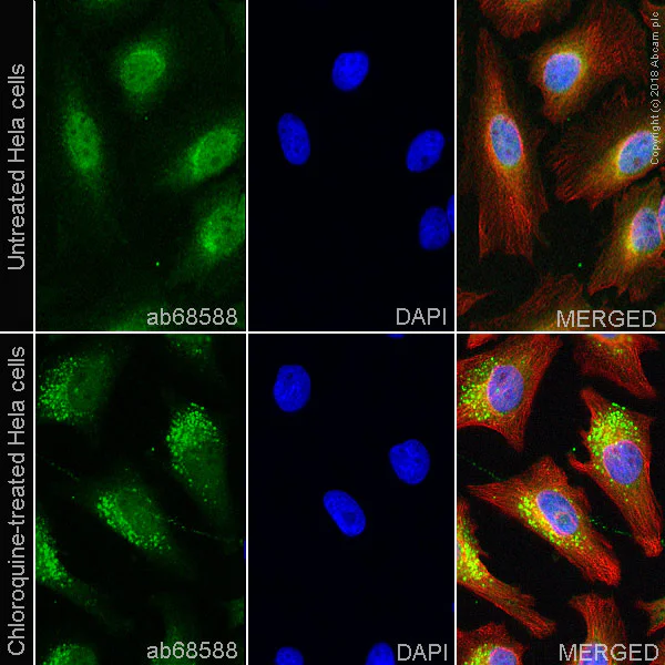 Immunocytochemistry/ Immunofluorescence - Anti-NDP52 antibody (AB68588)