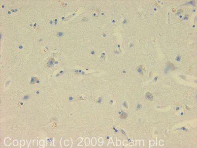 Immunohistochemistry (Formalin/PFA-fixed paraffin-embedded sections) - Anti-NDP52 antibody (AB68588)