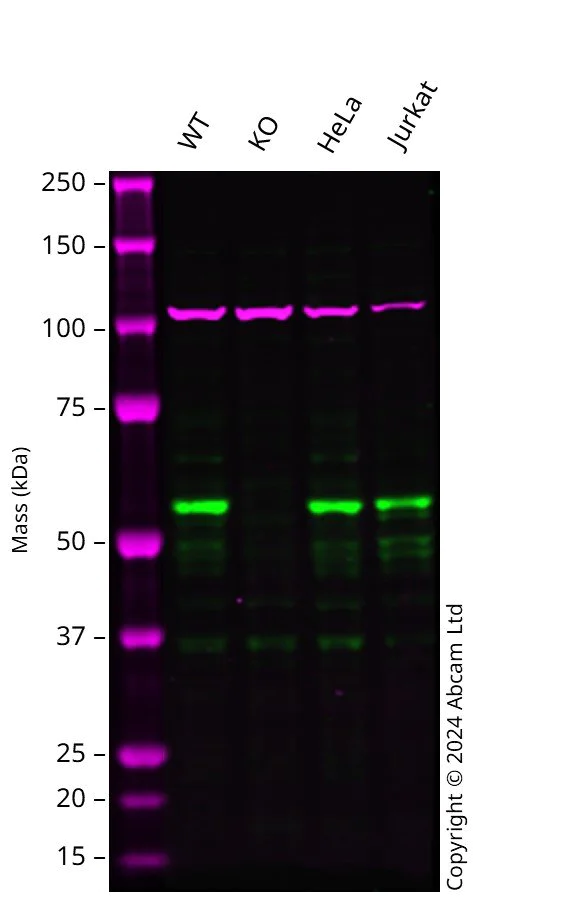 Western blot - Anti-NDP52 antibody (AB68588)