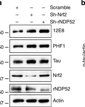 Western blot - Anti-NDP52 antibody (AB68588)