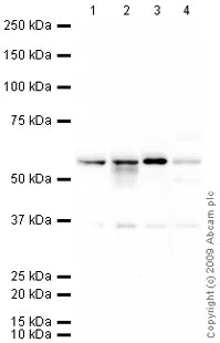 Western blot - Anti-NDP52 antibody (AB68588)