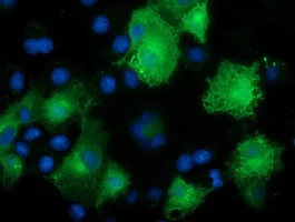 Immunocytochemistry/ Immunofluorescence - Anti-NDP52 antibody [OTI4H5] (AB124372)