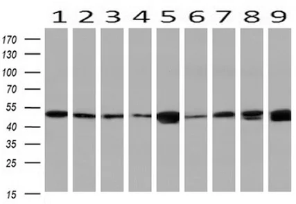 Western blot - Anti-NDP52 antibody [OTI4H5] (AB124372)