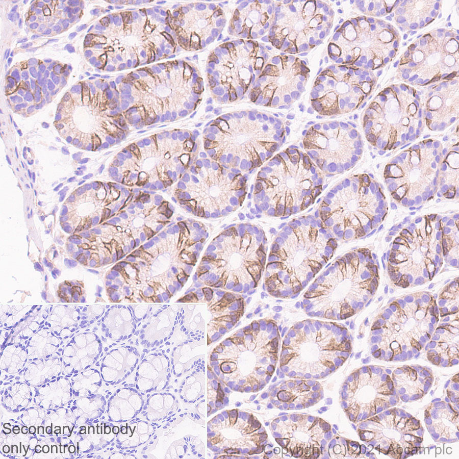 Immunohistochemistry (Formalin/PFA-fixed paraffin-embedded sections) - Anti-NDRG1 antibody [EPR5593] (ab124689), expandable thumbnail
