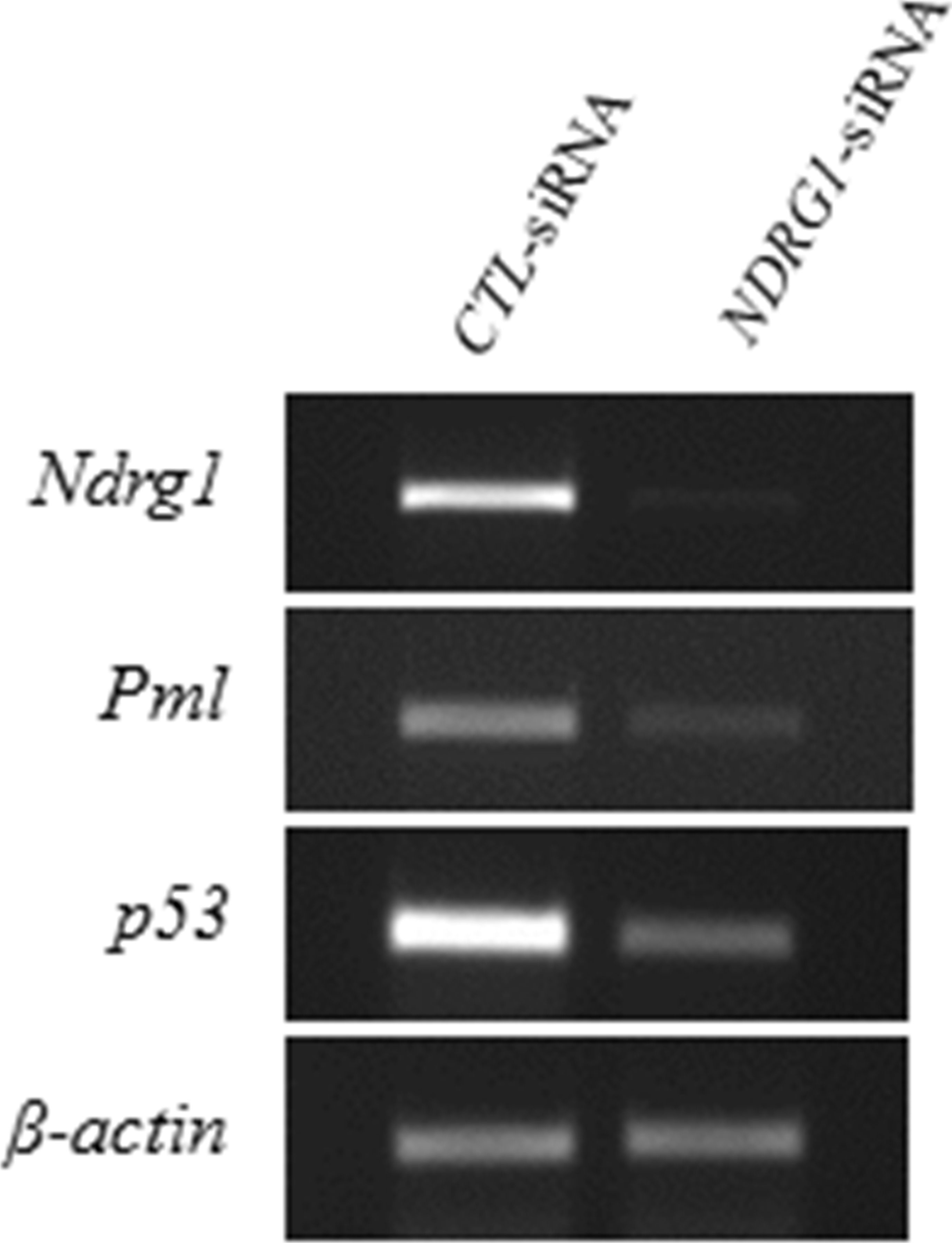 Western blot - Anti-NDRG1 antibody [EPR5593] (ab124689), expandable thumbnail