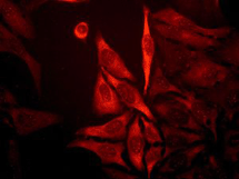 Immunocytochemistry/ Immunofluorescence - Anti-NDRG1 antibody [EPR5593] - Low endotoxin, Azide free (ab216457), expandable thumbnail