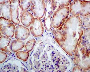 Immunohistochemistry (Formalin/PFA-fixed paraffin-embedded sections) - Anti-NDRG1 antibody [EPR5593] - Low endotoxin, Azide free (ab216457), expandable thumbnail