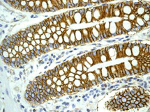 Immunohistochemistry (Formalin/PFA-fixed paraffin-embedded sections) - Anti-NDRG1 antibody [EPR5593] - Low endotoxin, Azide free (ab216457), expandable thumbnail