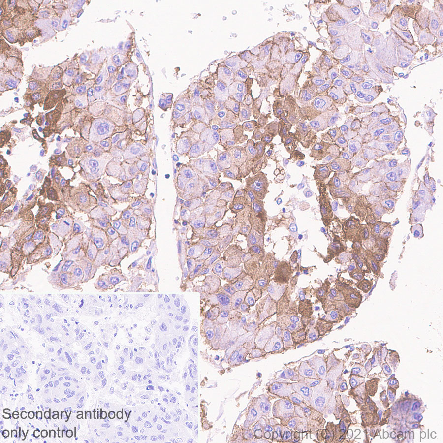 Immunohistochemistry (Formalin/PFA-fixed paraffin-embedded sections) - Anti-NDRG1 antibody [EPR5593] - Low endotoxin, Azide free (ab216457), expandable thumbnail