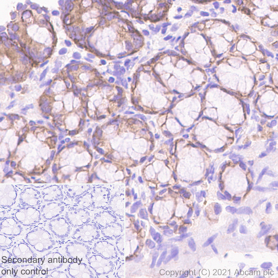 Immunohistochemistry (Formalin/PFA-fixed paraffin-embedded sections) - Anti-NDRG1 antibody [EPR5593] - Low endotoxin, Azide free (ab216457), expandable thumbnail