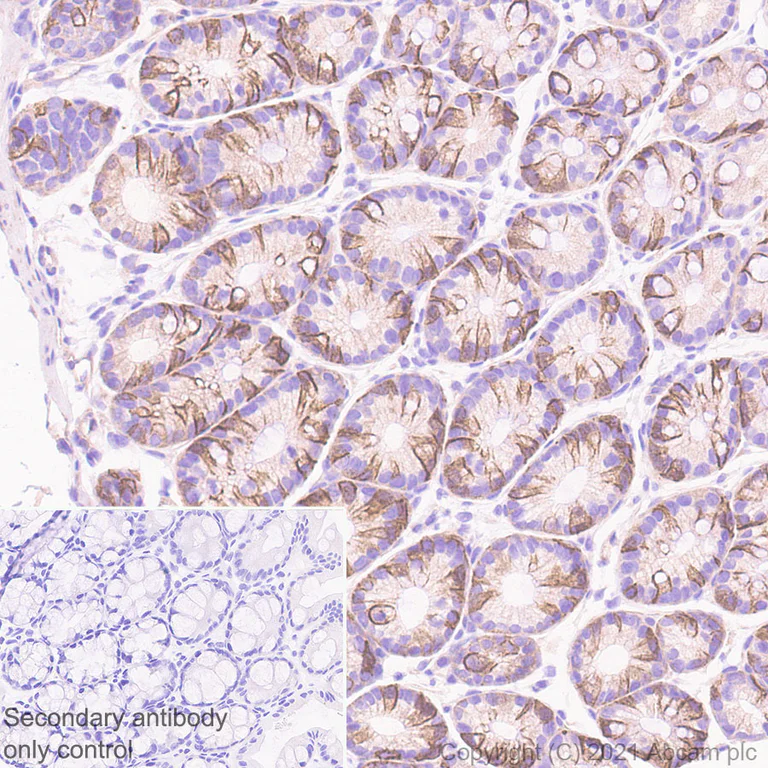 Immunohistochemistry (Formalin/PFA-fixed paraffin-embedded sections) - Anti-NDRG1 antibody [EPR5593] - Low endotoxin, Azide free (AB216457)