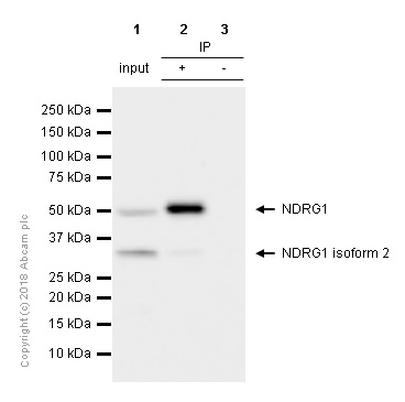 Immunoprecipitation - Anti-NDRG1 antibody [EPR5593] - Low endotoxin, Azide free (AB216457), expandable thumbnail