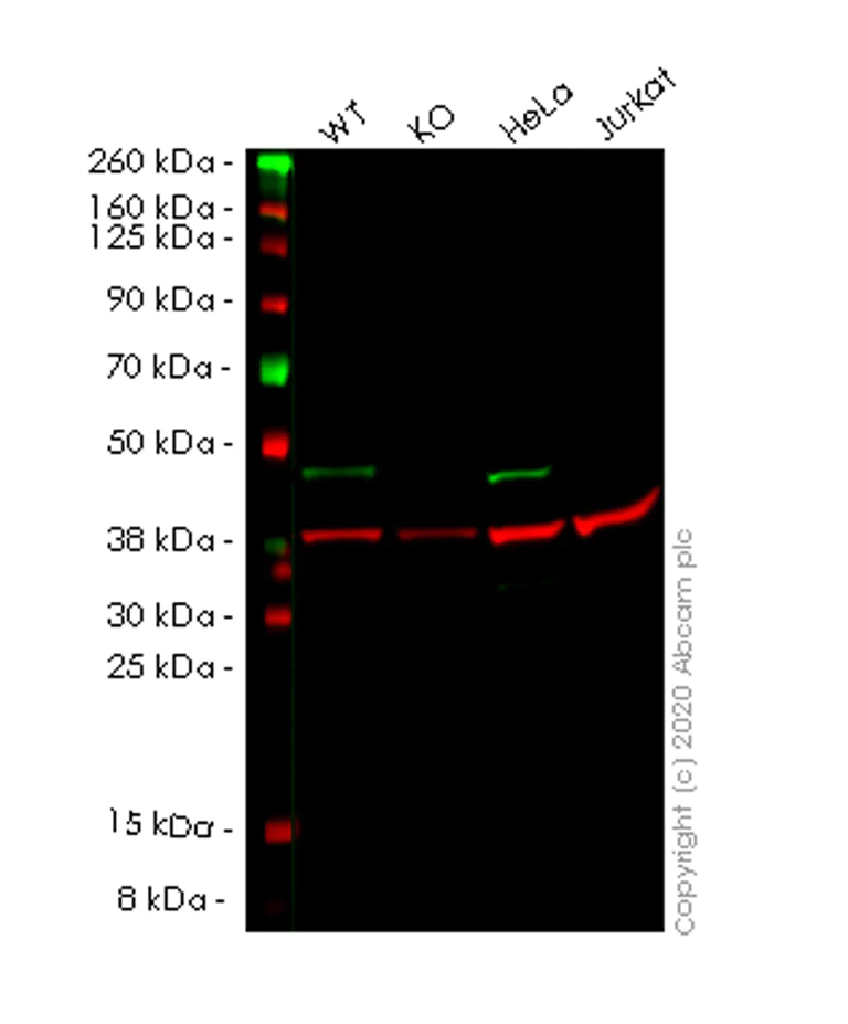Western blot - Anti-NDRG1 antibody [EPR5593] - Low endotoxin, Azide free (AB216457)