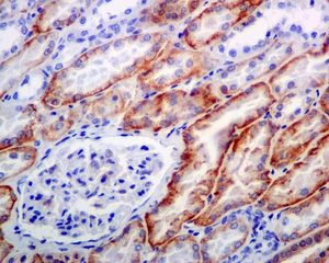 Immunohistochemistry (Formalin/PFA-fixed paraffin-embedded sections) - Anti-NDRG1 (phospho S330) antibody [EPR5594] (AB124713), expandable thumbnail
