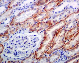 Immunohistochemistry (Formalin/PFA-fixed paraffin-embedded sections) - Anti-NDRG1 (phospho S330) antibody [EPR5594] - BSA and Azide free (AB247976)