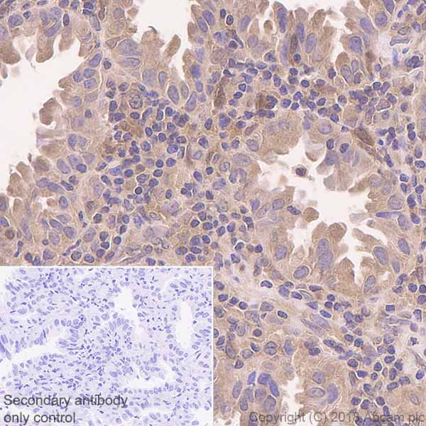 Immunohistochemistry (Formalin/PFA-fixed paraffin-embedded sections) - Anti-NDRG2 antibody [EPR11910] (AB174850), expandable thumbnail