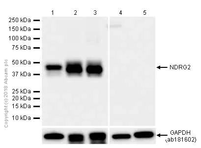 Western blot - Anti-NDRG2 antibody [EPR11910] (AB174850)