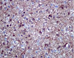 Immunohistochemistry (Formalin/PFA-fixed paraffin-embedded sections) - Anti-NDRG2 antibody [EPR11910] - BSA and Azide free (AB240181)