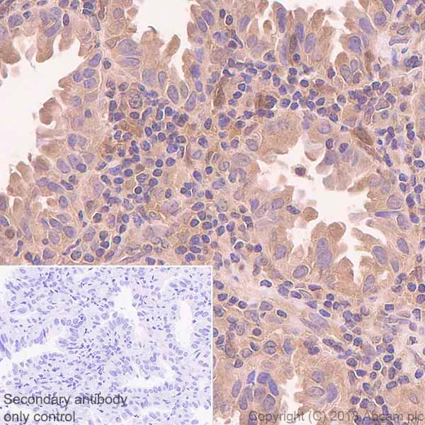 Immunohistochemistry (Formalin/PFA-fixed paraffin-embedded sections) - Anti-NDRG2 antibody [EPR11910] - BSA and Azide free (AB240181)