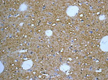 Immunohistochemistry (Formalin/PFA-fixed paraffin-embedded sections) - Anti-NDRG2 antibody [EPR11911(B)] (AB169775)