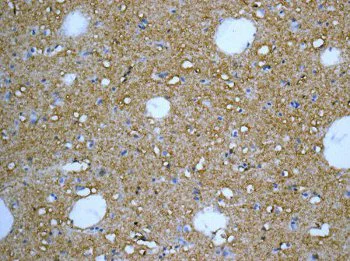 Immunohistochemistry (Formalin/PFA-fixed paraffin-embedded sections) - Anti-NDRG2 antibody [EPR11911(B)] - BSA and Azide free (AB249521)