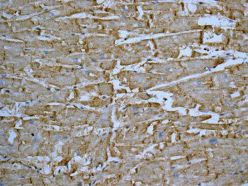 Immunohistochemistry (Formalin/PFA-fixed paraffin-embedded sections) - Anti-NDRG2 antibody [EPR11911(B)] - BSA and Azide free (AB249521)