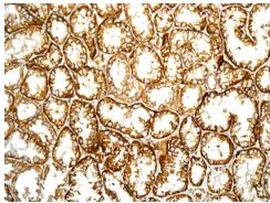 Immunohistochemistry (Formalin/PFA-fixed paraffin-embedded sections) - Anti-NDRG3 antibody [EPR9010(B)] (AB131266)