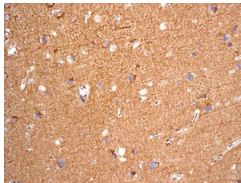 Immunohistochemistry (Formalin/PFA-fixed paraffin-embedded sections) - Anti-NDRG3 antibody [EPR9010(B)] (AB131266)