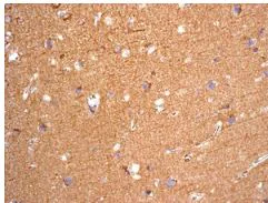Immunohistochemistry (Formalin/PFA-fixed paraffin-embedded sections) - Anti-NDRG3 antibody [EPR9010(B)] (AB131266)