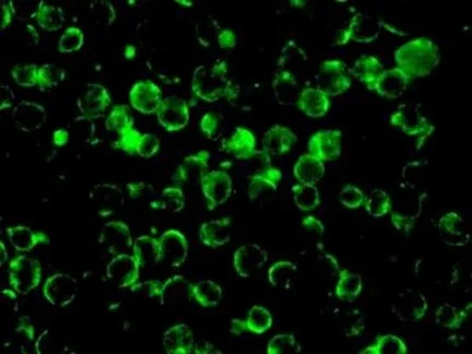 Immunocytochemistry/ Immunofluorescence - Anti-NDRG3 antibody [EPR9011(B)] (AB133715)